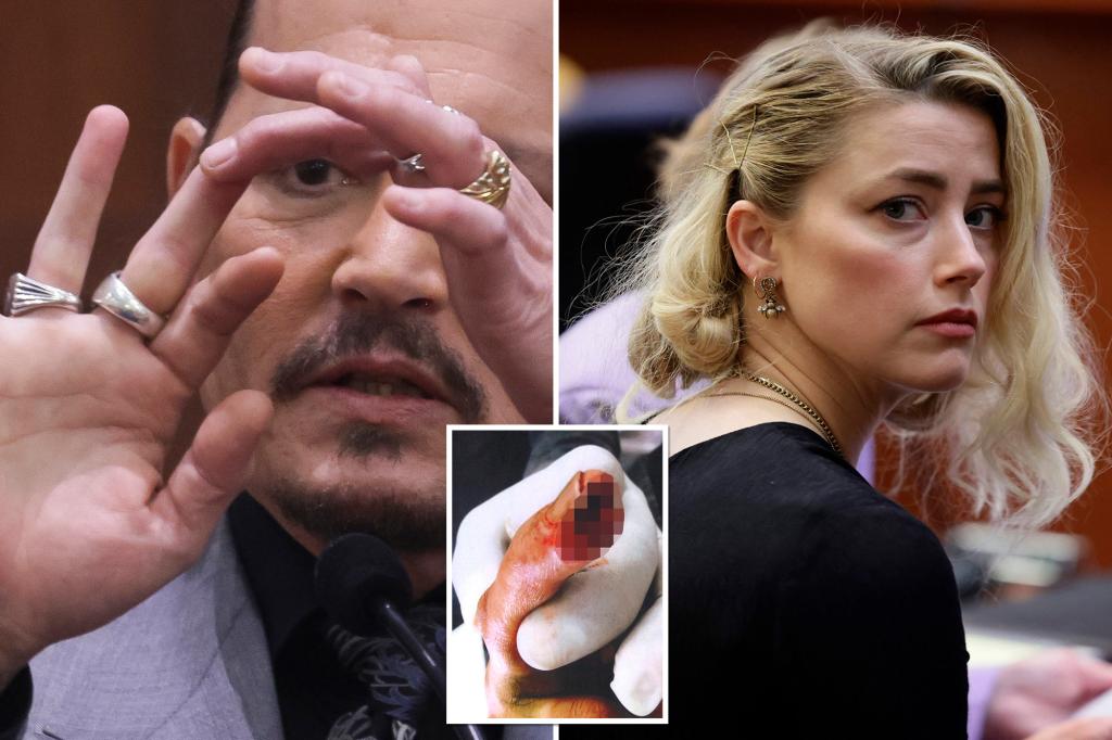 De zus van Heard zei dat de actrice Depps vinger afsneed: Docs